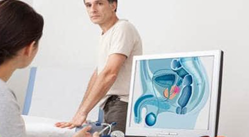 Symptoms of prostate cancer: Look with photos