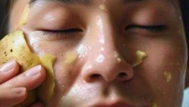 What happens by rubbing potatoes on the face?