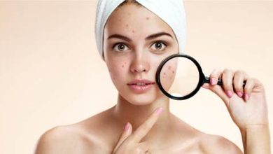 Prevention of Acne: Photographer