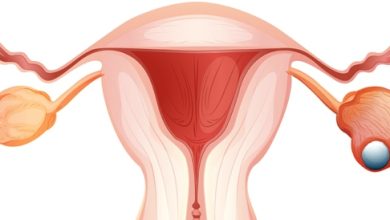 Ovarian cancer: Causes, symptoms and treatment