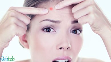 Video: Prevention of Acne