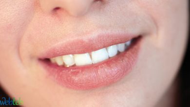 Look at photos: the causes of dry mouth
