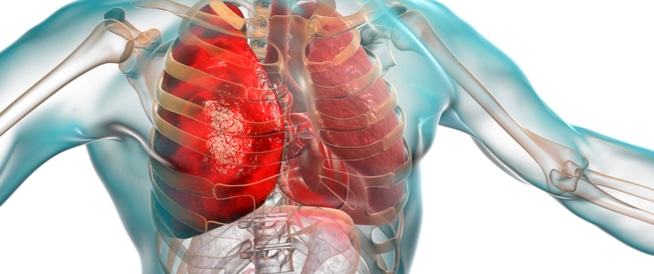 Pneumonia: Causes, Symptoms and Treatment