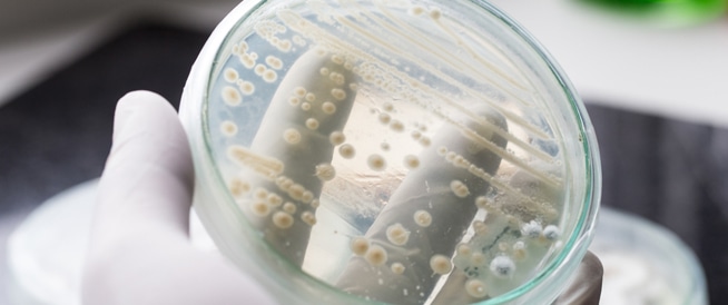 Vaginal Fungi: Causes, Symptoms and Treatment