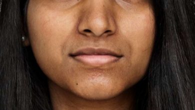 These 3 things can spoil your face