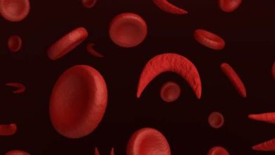 Emogy blood poverty: symptoms, causes and treatment