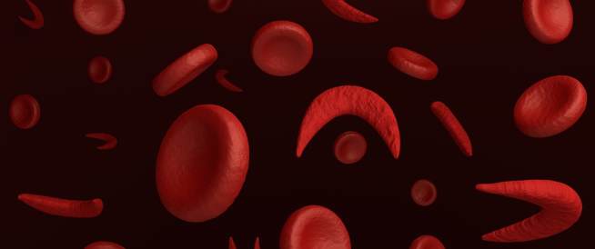 Emogy blood poverty: symptoms, causes and treatment