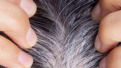 White hair will only be after the age of 40 after the age of 40