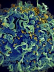 HIV infection is the highest in these ten countries