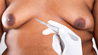Treatment of men’s