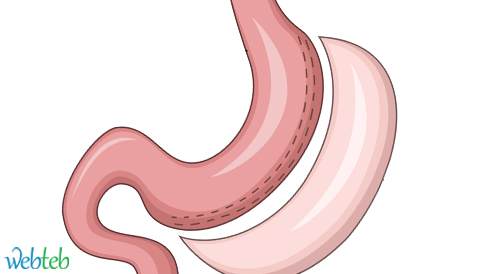 Watch the video: Stomach gag process