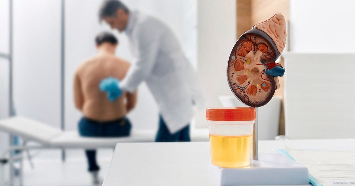 Artificial intelligence can be a revolution in the kidney transplant … “more accurate tool”
