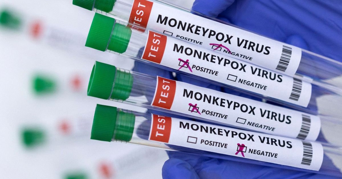 Germany records the first infection with a new, glowing stem of the A Appeals