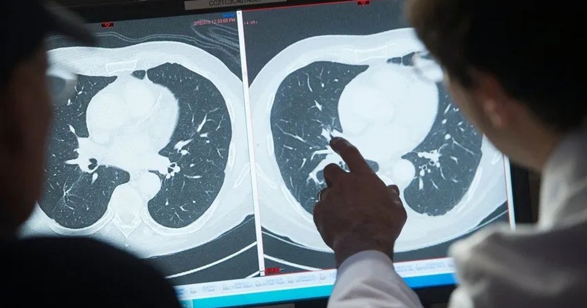 Development of cancer treatment that attacks the protein that causes the disease carefully