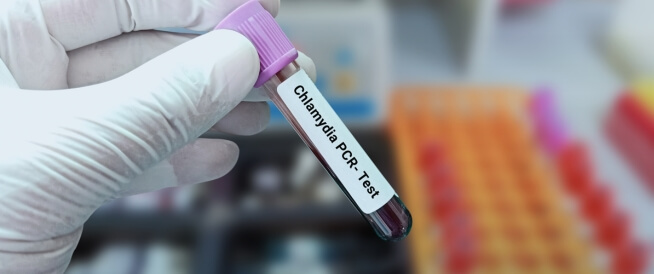 Chlamydia: Causes, Symptoms and Treatment