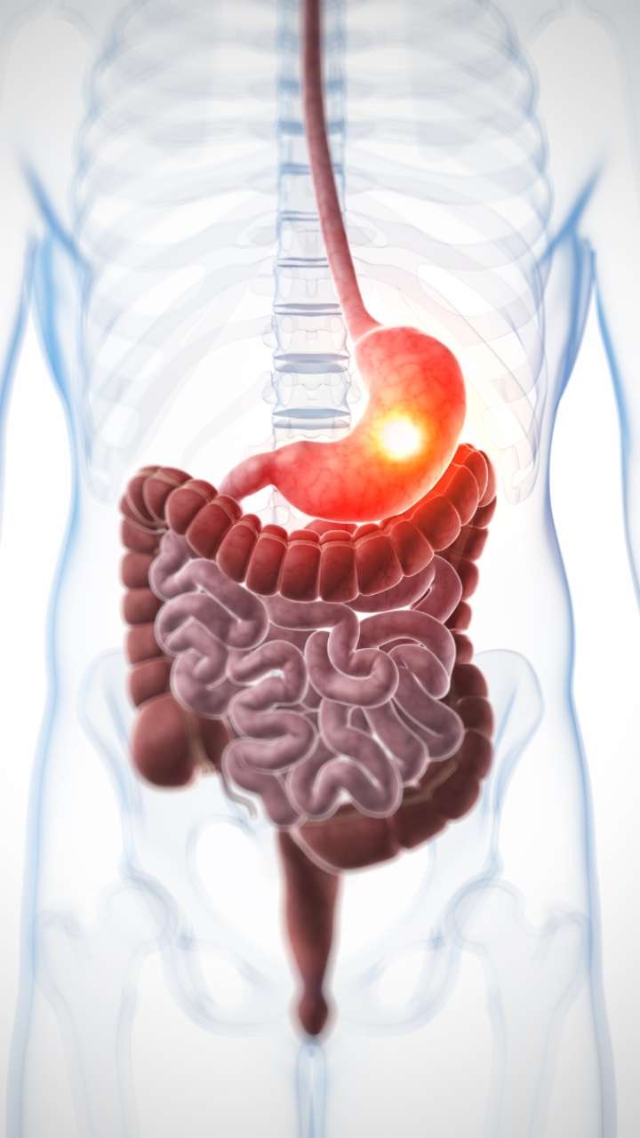 What are the early symptoms of stomach cancer?