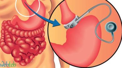 Watch the video: Connect the stomach to the endoscope
