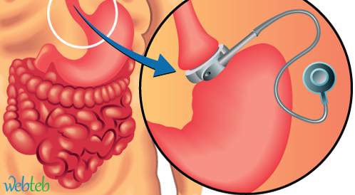 Watch the video: Connect the stomach to the endoscope