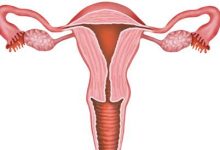 Uterine examination and fallopian tubes to evaluate fertility in women