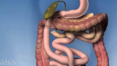 Stomach gag process and transformation of the bowel path