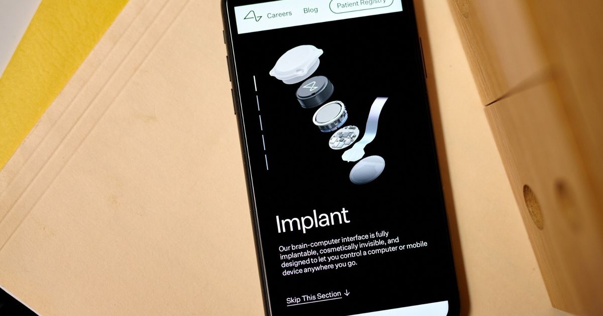 Muskus: “Neuralink” has planted a brain system with a third patient