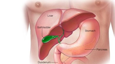 Pancreatic cancer .. Causes, symptoms and patient options in treatment