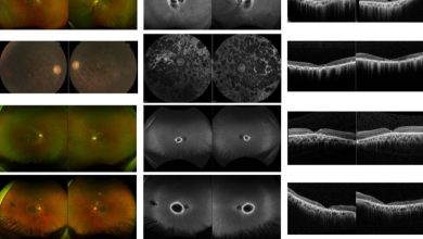 The discovery of a new gene linked to genetic eye diseases