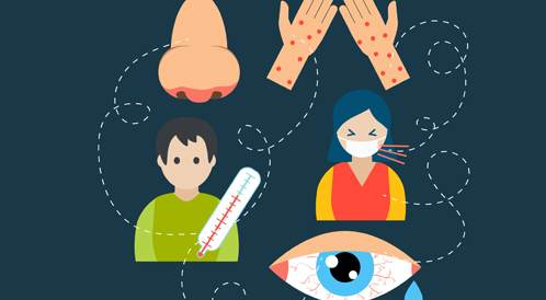 What happens in the body during an allergic reaction?