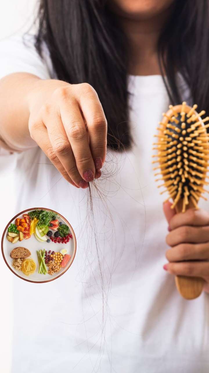 Not expensive products, eat these 5 foods to stop hairfall