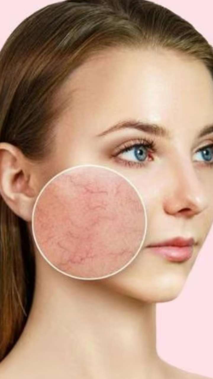 These 7 steps will glow dry skin