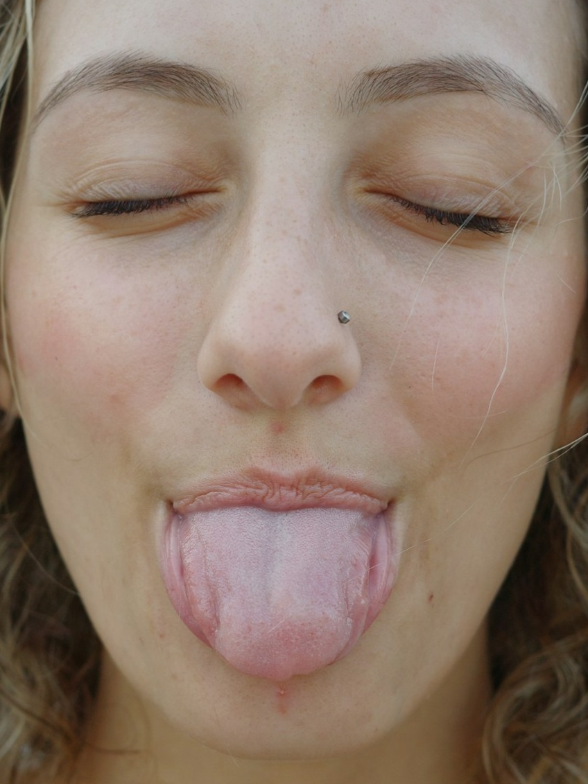 White layer, illness or indifference on the tongue?