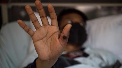 Pakistan investigates travelers as a precaution of the chickenpox virus