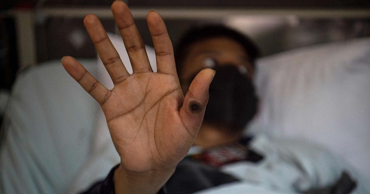 Pakistan investigates travelers as a precaution of the chickenpox virus