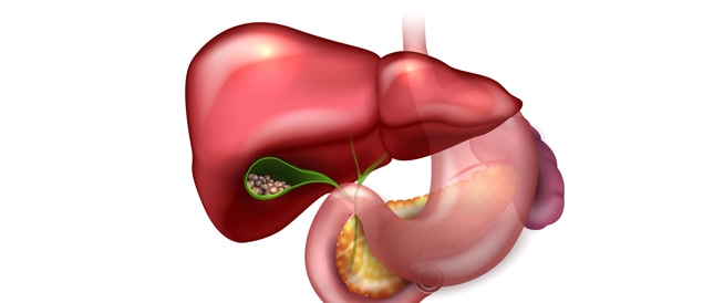 Bitter inflammation: causes, symptoms and treatment