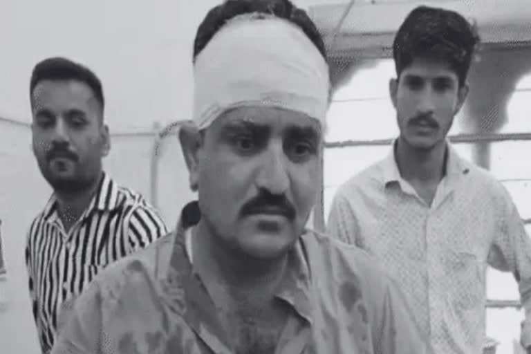 Case filed against the brother and son of BJP MLA on charges of fatal attack, see the accused of setting fire to the video