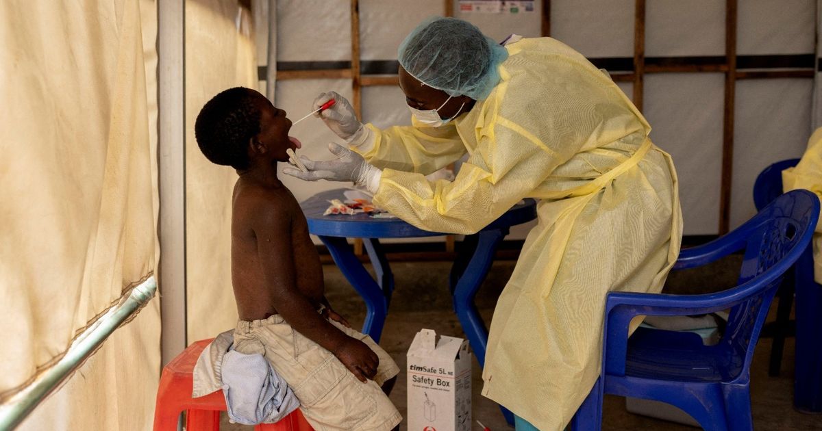 The smallpox has spread in different African countries … and the announcement of “an emergency”