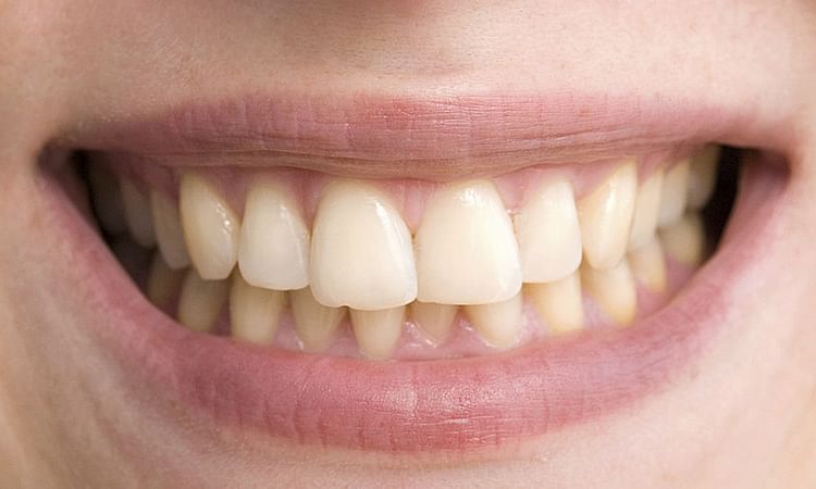 Teeth keeping the heart sick – ryan