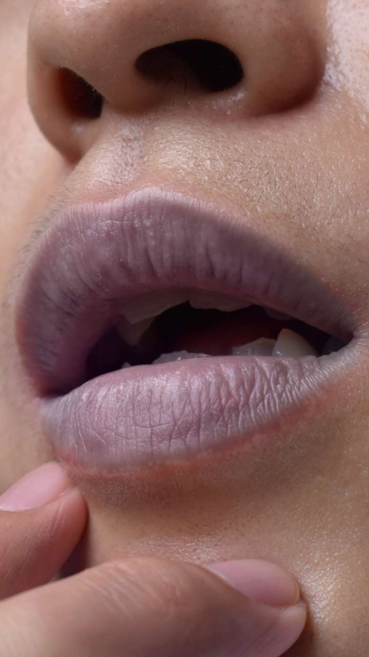 Why does the color of the lips turn black? File
