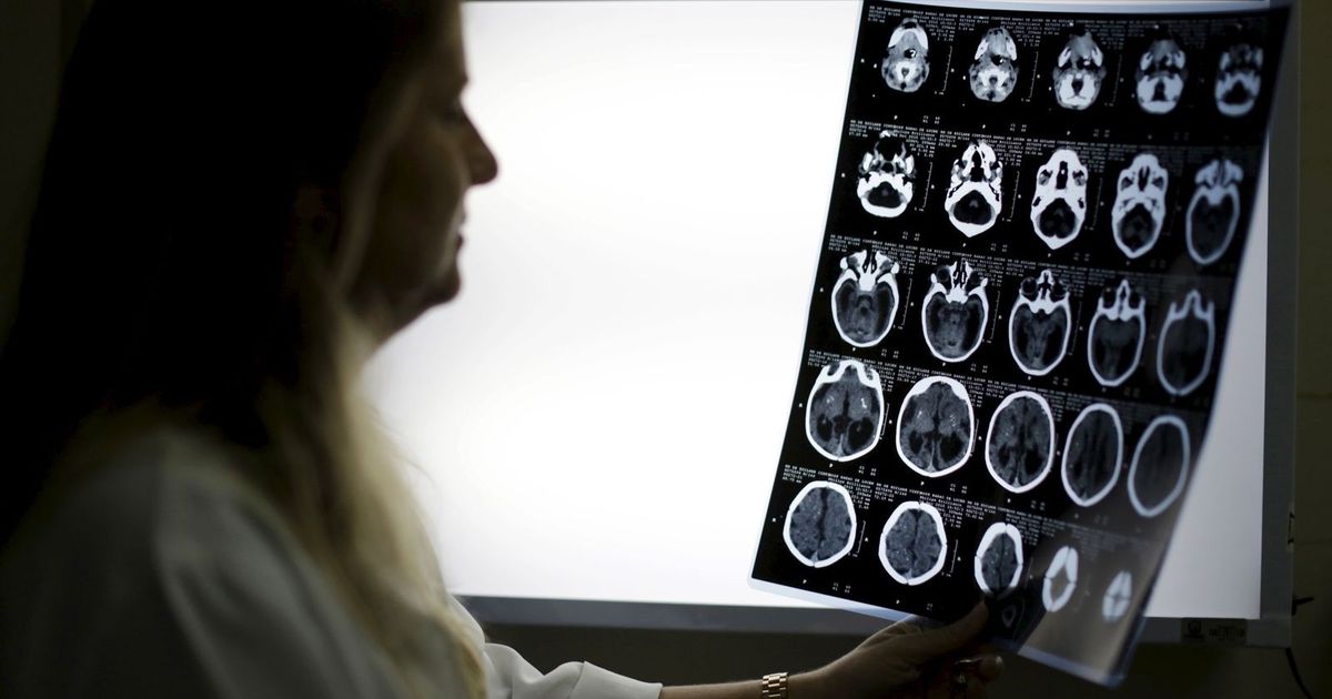 “Theta Explosion” .. a technique that paves the way to treat bipolar disorder