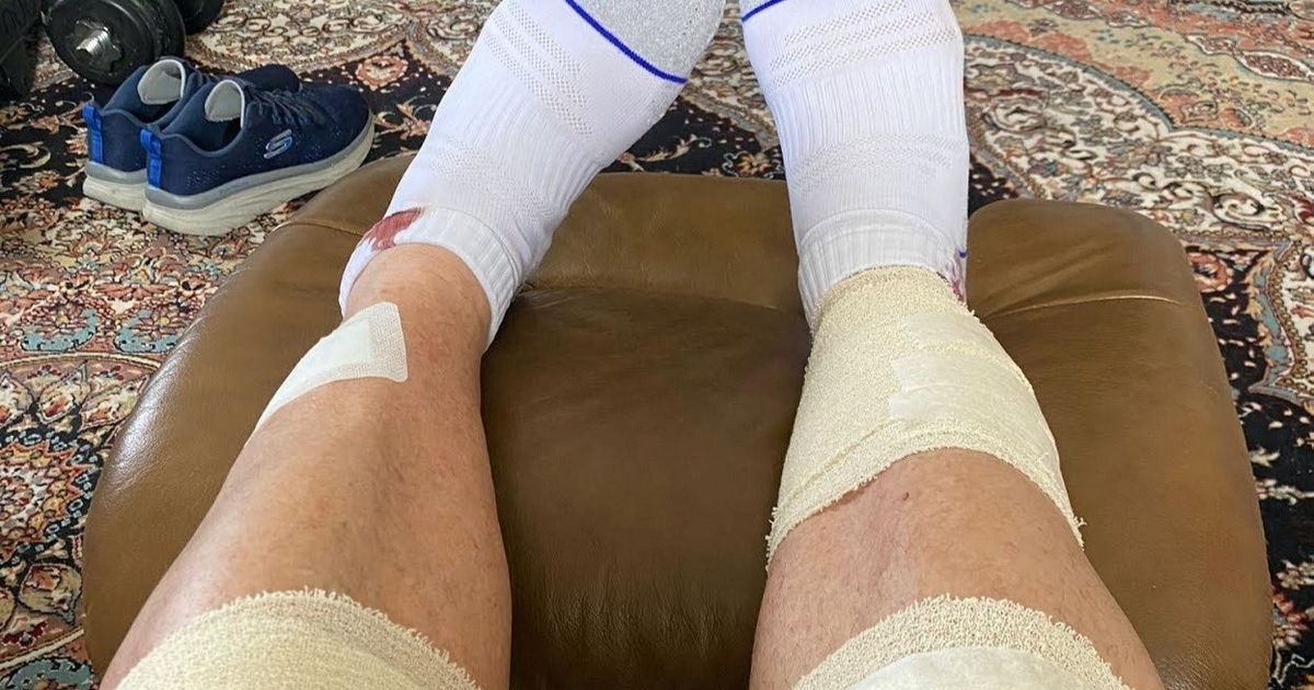 Tips to prevent the swelling and foot of the leg during air trip