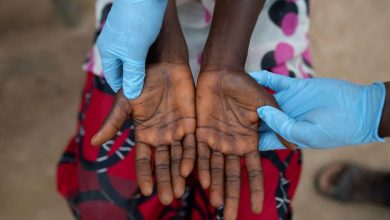 “World Health” asks for urgent action against “monkey frogs” in Africa