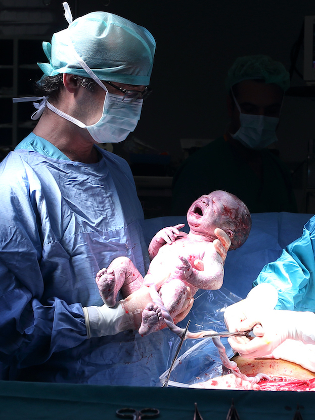 C-section delivery danger or coercion?