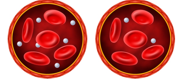 Lack of blood sugar: causes, symptoms and treatment