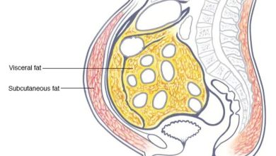 Reasons for obtaining abdominal fats and tips to get rid of it