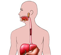 Hijabi Hernia: Symptoms, Causes and Treatment