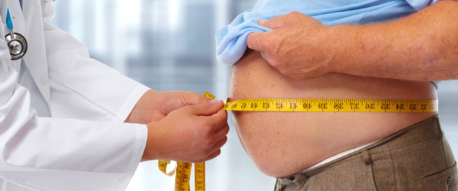 Obesity: Symptoms, Causes and Treatment