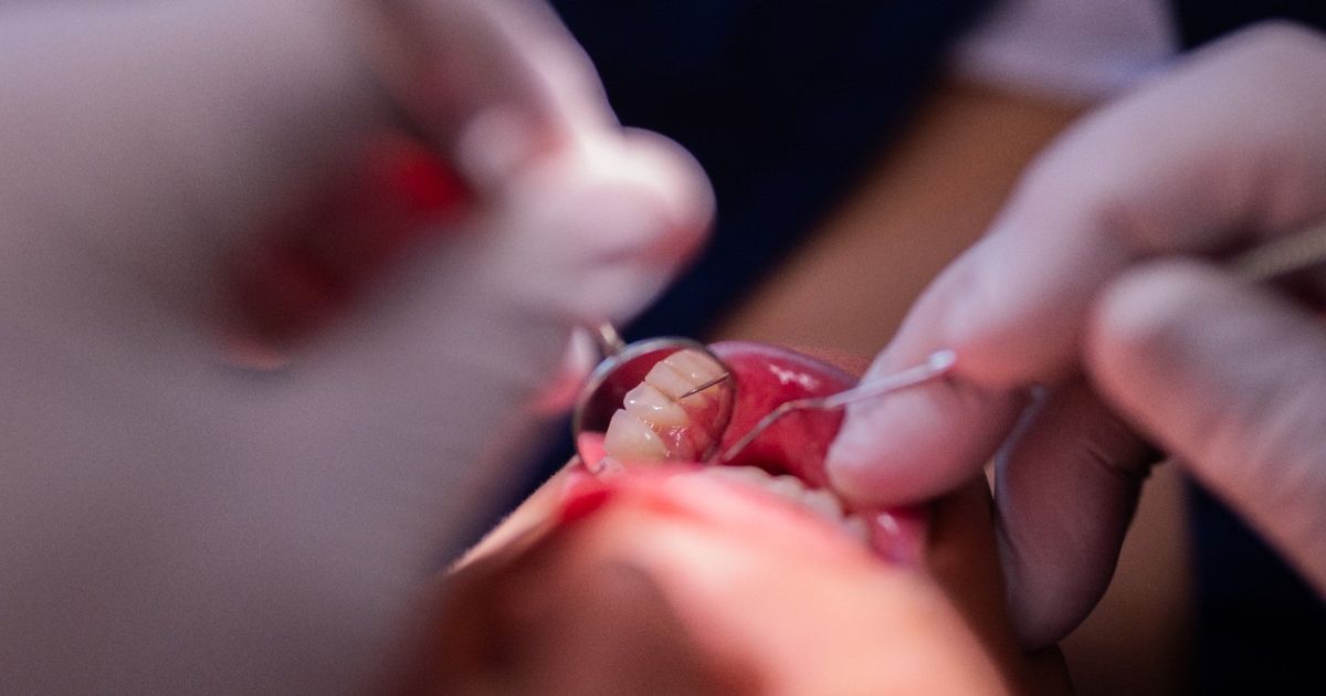 Dental abscess .. 7 tips to prevent dangerous pain