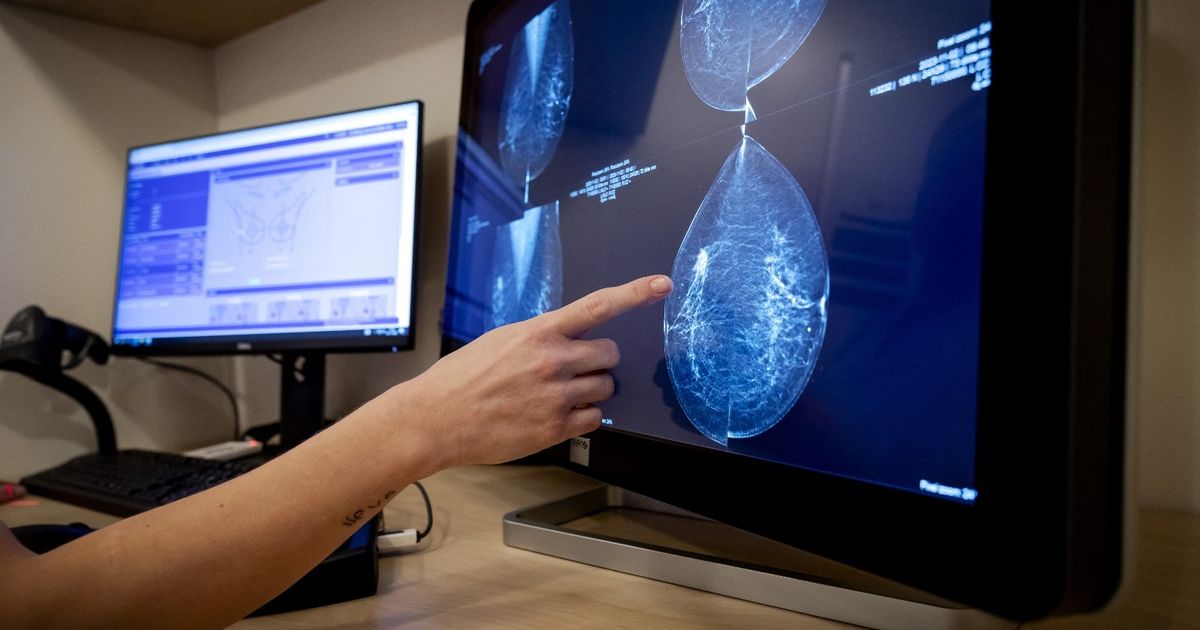 New Genes for Breast Cancer In Women of Africa Rising can improve the prediction of the disease