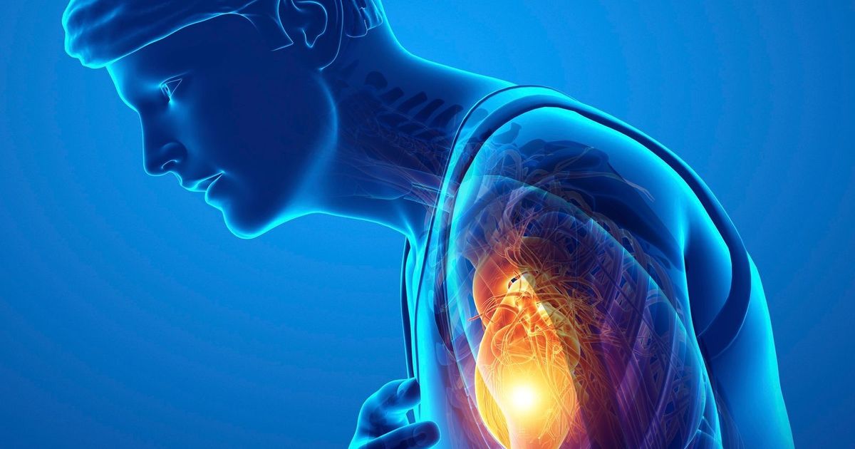Causes of broken heart syndrome and symptoms require a doctor