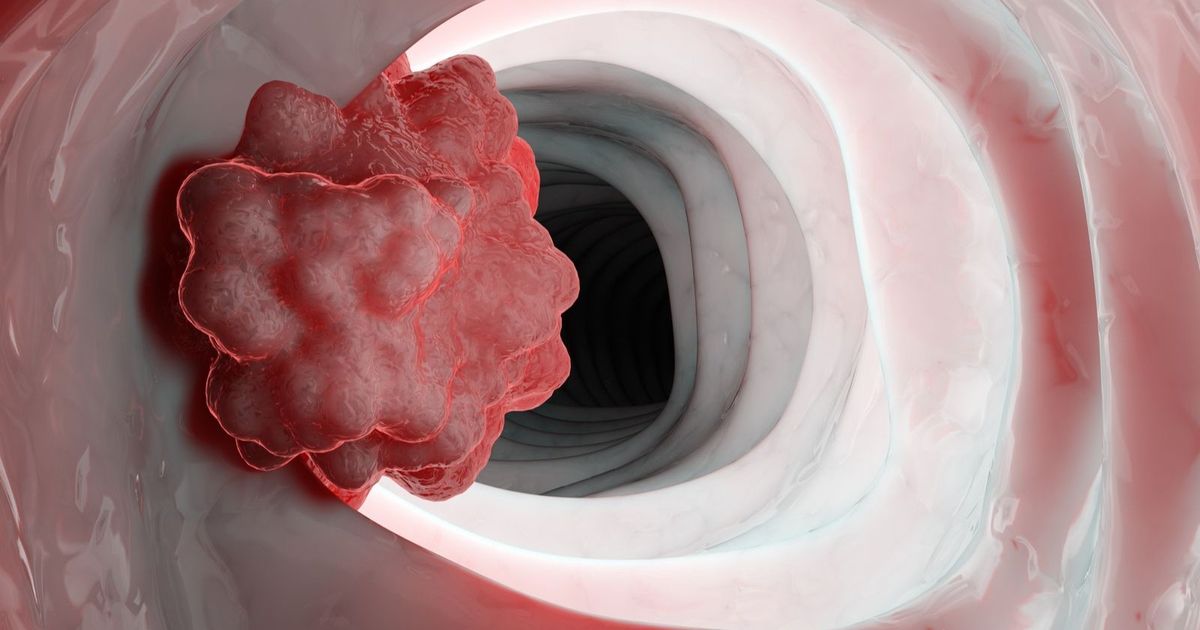 A new assistant “vaccine” increases the immunity from cancer crops